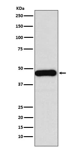 Western Blot: HDJ2 Antibody (SR1766) [NBP3-22270] - Western blot analysis using NBP3-22270 in Jurkat cell lysate.