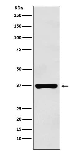 Western Blot: PIM2 Antibody (SR1624) [NBP3-22271] - Western blot analysis using NBP3-22271 in Raji cell lysate.