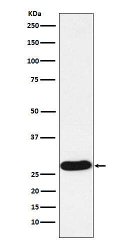 Western Blot: Proteinase 3/Myeloblastin/PRTN3 Antibody (SR1444) [NBP3-22274] - Western blot analysis using NBP3-22274 in HL60 cell lysate.