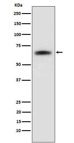 Western Blot: SENP2 Antibody (SR2130) [NBP3-22280] - Western blot analysis using NBP3-22280 in 293T cell lysate.
