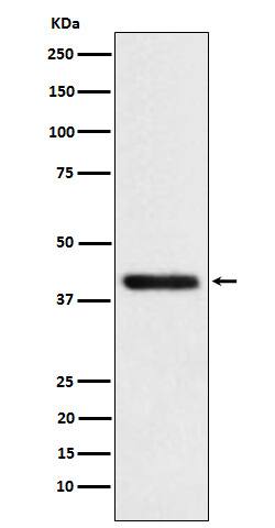 Western Blot: Tropomodulin 2 Antibody (SR1682) [NBP3-22282] - Western blot analysis using NBP3-22282 in SH-SY5Y cell lysate.