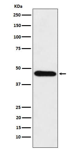 Western Blot: CDC123 Antibody (SR1649) [NBP3-22283] - Western blot analysis using NBP3-22283 in HeLa cell lysate.