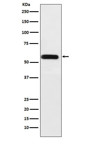 Western Blot: Angiopoietin-like Protein 3/ANGPTL3 Antibody (SR1955) [NBP3-22287] - Western blot analysis using NBP3-22287 in A375 cell lysate.