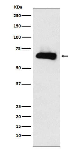 Western Blot: CRMP4 Antibody (SR2081) [NBP3-22288] - Western blot analysis using NBP3-22288 in Human fetal brain lysate.
