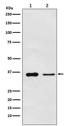 Western Blot: PDLIM1 Antibody (SR1603) [NBP3-22289] - Western blot analysis using NBP3-22289 in (1) Saos2 cell lysate; (2) Mouse lung lysate.