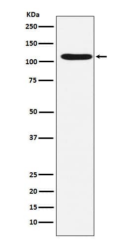 Western Blot: HIRA Antibody (SR1066) [NBP3-22291] - Western blot analysis using NBP3-22291 in HeLa cell lysate.