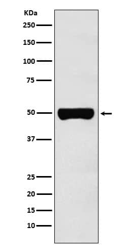 Western Blot: CHX10 Antibody (SR1872) [NBP3-22295] - Western blot analysis using NBP3-22295 in Y79 cell lysate.