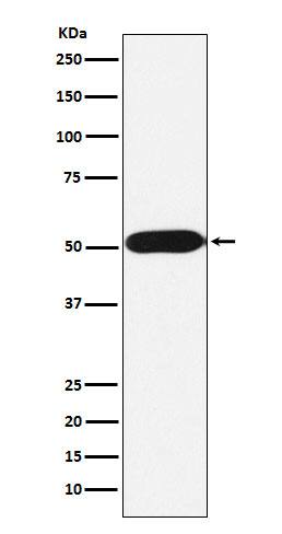 Western Blot: FKBP38 Antibody (SR1916) [NBP3-22302] - Western blot analysis using NBP3-22302 in Jurkat cell lysate.