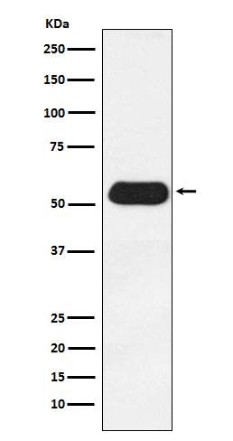 Western Blot: ERR gamma/NR3B3 Antibody (SR1899) [NBP3-22303] - Western blot analysis using NBP3-22303 in Human fetal heart lysate.