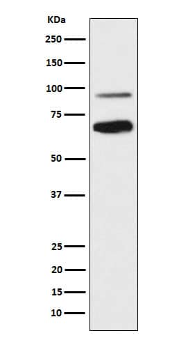 Western Blot: TCF4 Antibody (SR2168) [NBP3-22305] - Western blot analysis using NBP3-22305 in SH-SY5Y cell lysate.