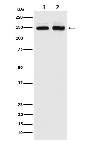 Western Blot: PIK3R4 Antibody (SR1197) [NBP3-22308] - Western blot analysis using NBP3-22308 in (1) Jurkat cell lysate; (2) Molt-4 cell lysate.