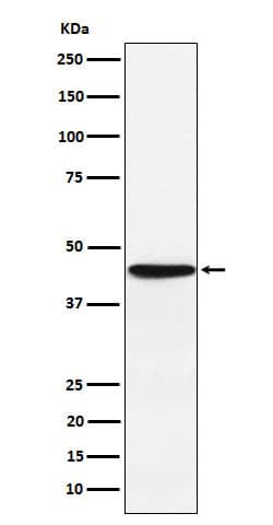 Western Blot: HLA F Antibody (SR1707) [NBP3-22318] - Western blot analysis using NBP3-22318 in JAR cell lysate.