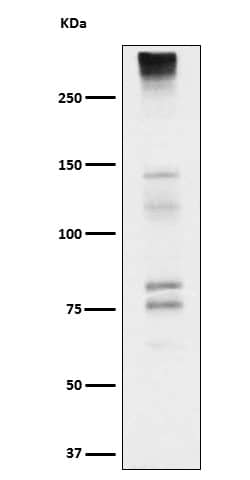 Western Blot: Neurocan Antibody (SR1121) [NBP3-22319] - Western blot analysis using NBP3-22319 in Fetal brain cell lysate.