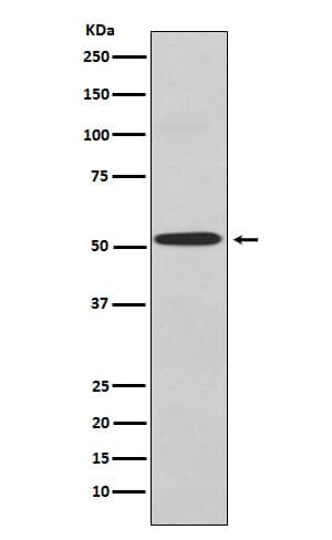 Western Blot: Kir2.1 Antibody (SR1939) [NBP3-22328] - Western blot analysis using NBP3-22328 in A549 cell lysate.