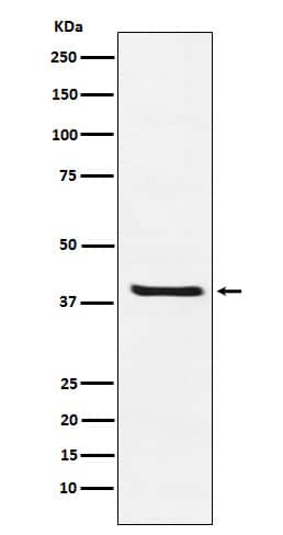 Western Blot: ARG2 Antibody (SR1648) [NBP3-22334] - Western blot analysis using NBP3-22334 in 293T cell lysate.