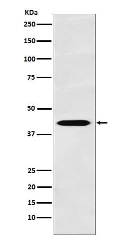 Western Blot: TROY/TNFRSF19 Antibody (SR1804) [NBP3-22336] - Western blot analysis using NBP3-22336 in LnCaP cell lysate.