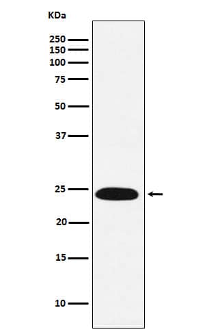 Western Blot: VPS28 Antibody (SR1407) [NBP3-22341] - Western blot analysis using NBP3-22341 in Jurkat cell lysate.