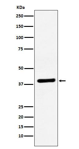 Western Blot: VEGF-D Antibody (SR1683) [NBP3-22342] - Western blot analysis using NBP3-22342 in Caco-2 cell lysate.