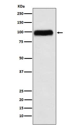 Western Blot: Serpin G1/C1 Inhibitor Antibody (SR1022) [NBP3-22363] - Western blot analysis using NBP3-22363 in Human plasma lysate.