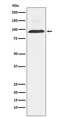 Western Blot: Dynamin 3 Antibody (SR2308) [NBP3-22364] - Western blot analysis using NBP3-22364 in Human fetal brain lysate.