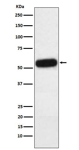 Western Blot: Fetuin A/AHSG Antibody (SR2026) [NBP3-22369] - Western blot analysis using NBP3-22369 in Human plasma lysate.