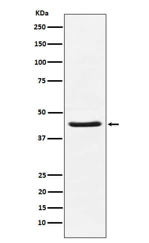 Western Blot: HSD3B1 Antibody (SR1710) [NBP3-22373] - Western blot analysis using NBP3-22373 in Human placenta lysate.
