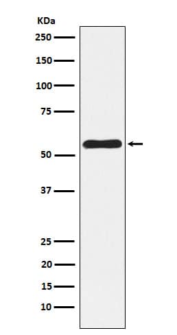 Western Blot: NLK Antibody (SR2028) [NBP3-22377] - Western blot analysis using NBP3-22377 in A375 cell lysate.
