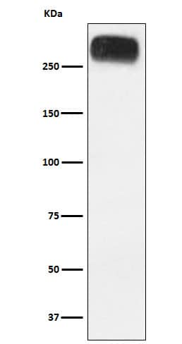 Western Blot: mGluR3 Antibody (SR1543) [NBP3-22382] - Western blot analysis using NBP3-22382 in Human cerebellum lysate.