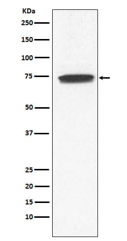 Western Blot: Guanylyl Cyclase alpha 1 Antibody (SR2180) [NBP3-22388] - Western blot analysis using NBP3-22388 in Human fetal kidney lysate.