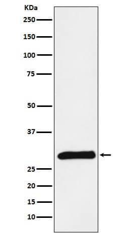 Western Blot: Trypsin 2/PRSS2 Antibody (SR1515) [NBP3-22389] - Western blot analysis using NBP3-22389 in Human pancreas lysate.