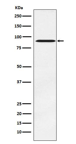 Western Blot: ATRIP Antibody (SR2262) [NBP3-22394] - Western blot analysis using NBP3-22394 in PC-3 cell lysate.