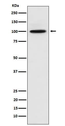 Western Blot: CTNNA3 Antibody (SR1012) [NBP3-22396] - Western blot analysis using NBP3-22396 in 293 cell lysate.