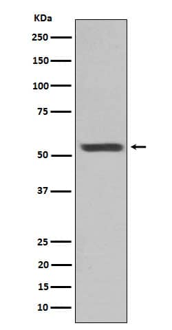 Western Blot: Cytokeratin 12 Antibody (SR1957) [NBP3-22398] - Western blot analysis using NBP3-22398 in mouse eyeball lysate.