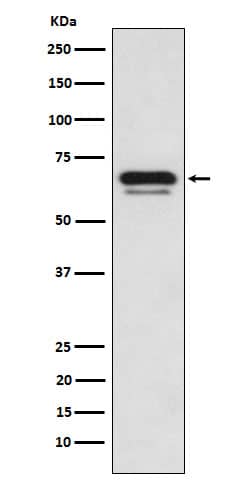 Western Blot: p66 alpha Antibody (SR2093) [NBP3-22399] - Western blot analysis using NBP3-22399 in K562 cell lysate.