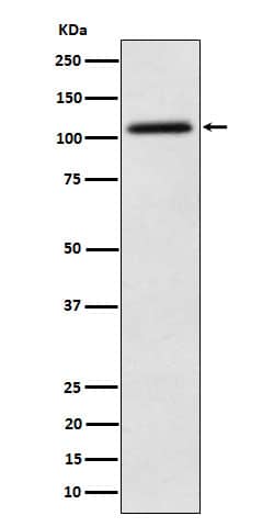 Western Blot: NAT10 Antibody (SR1073) [NBP3-22400] - Western blot analysis using NBP3-22400 in Hela cell lysate.