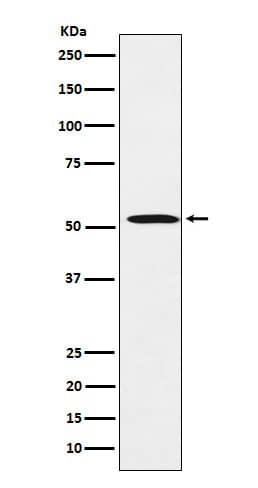 Western Blot: FADS1 Antibody (SR1912) [NBP3-22409] - Western blot analysis using NBP3-22409 in HepG2 cell lysate.