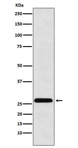 Western Blot: HLA DRB4 Antibody (SR1504) [NBP3-22412] - Western blot analysis using NBP3-22412 in Raji cell lysate.