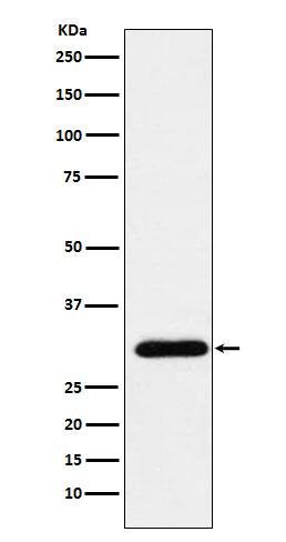 Western Blot: RAP30 Antibody (SR1503) [NBP3-22418] - Western blot analysis using NBP3-22418 in HeLa cell lysate.