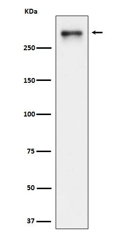 Western Blot: USP24 Antibody (SR1479) [NBP3-22428] - Western blot analysis using NBP3-22428 in HeLa cell lysate.
