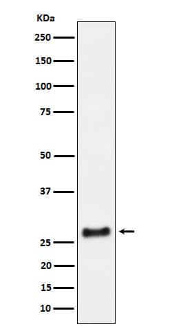 Western Blot: SNRPA1 Antibody (SR1474) [NBP3-22432] - Western blot analysis using NBP3-22432 in HeLa cell lysate.