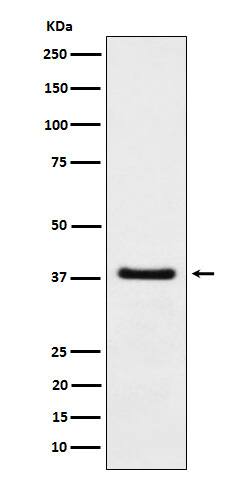 Western Blot: HDGF Antibody (SR1616) [NBP3-22437] - Western blot analysis using NBP3-22437 in A549 cell lysate.