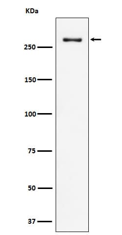 Western Blot: CHD3 Antibody (SR1410) [NBP3-22441] - Western blot analysis using NBP3-22441 in HeLa cell lysate.