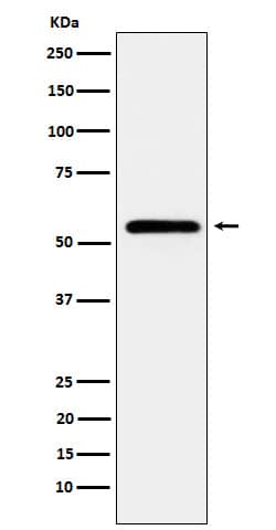 Western Blot: CaM Kinase II Antibody (SR1856) [NBP3-22447] - Western blot analysis using NBP3-22447 in HeLa cell lysate.