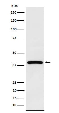 Western Blot: NCF4 Antibody (SR1655) [NBP3-22455] - Western blot analysis using NBP3-22455 in MCF7 cell lysate.