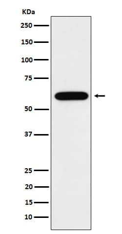 Western Blot: Tubby Antibody (SR2068) [NBP3-22458] - Western blot analysis using NBP3-22458 in Neuro-2a cell lysate.