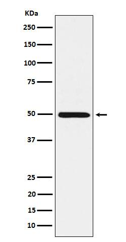 Western Blot: HGD Antibody (SR1835) [NBP3-22463] - Western blot analysis using NBP3-22463 in HepG2 cell lysate.