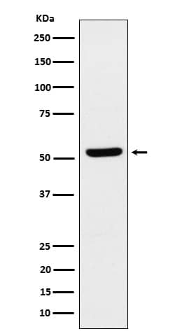 Western Blot: ZNF259 Antibody (SR1907) [NBP3-22465] - Western blot analysis using NBP3-22465 in MCF7 cell lysate.