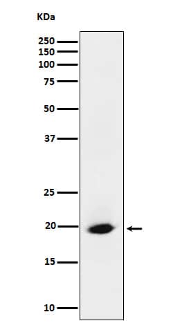 Western Blot: SRP19 Antibody (SR1318) [NBP3-22472] - Western blot analysis using NBP3-22472 in HeLa cell lysate.