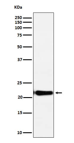 Western Blot: c-Myc-responsive protein Rcl Antibody (SR1326) [NBP3-22474] - Western blot analysis using NBP3-22474 in HeLa cell lysate.