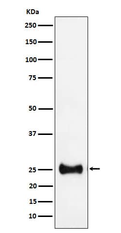 Western Blot: AK3L1 Antibody (SR1388) [NBP3-22475] - Western blot analysis using NBP3-22475 in HepG2 cell lysate.